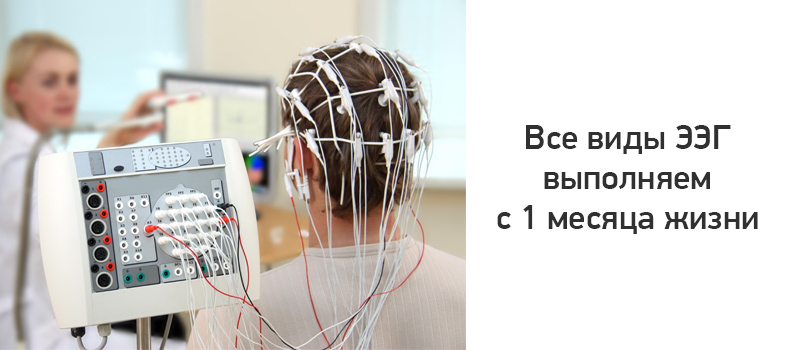 Ээг пермь. Электроэнцефалограф-анализатор ЭЭГА-21/26- Энцефалан-131-03. ЭЭГ. ЭЭГ головного мозга. ЭЭГ аппарат.