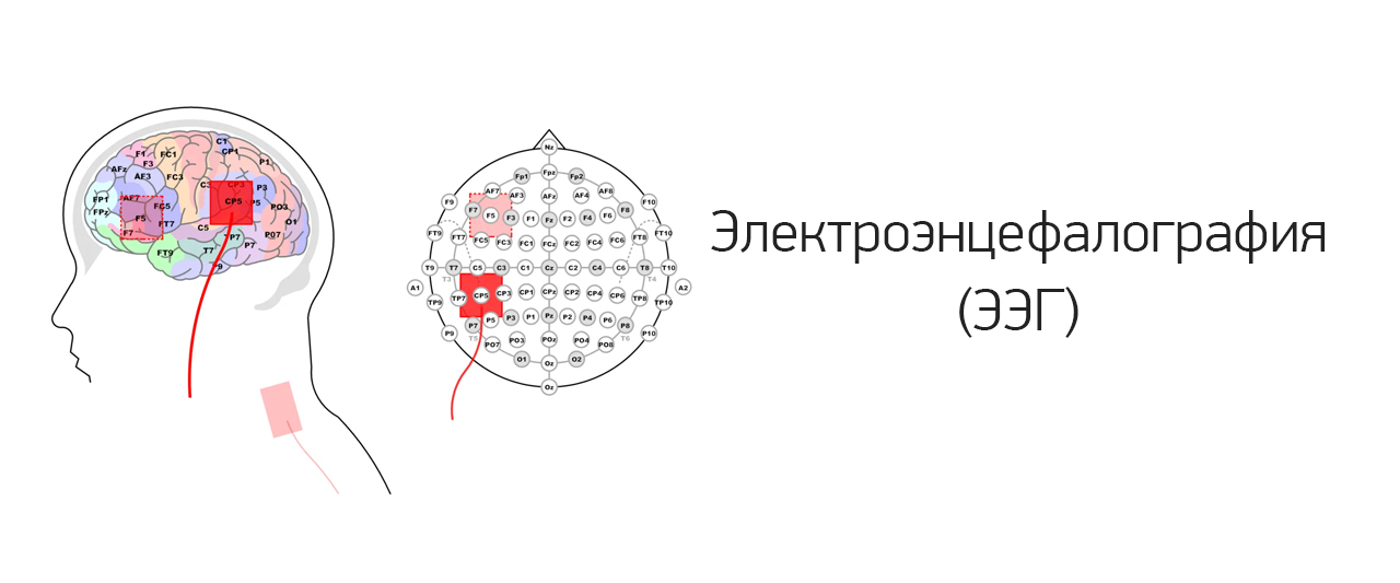 Запишитесь на диагностику ЭЭГ прямо сейчас