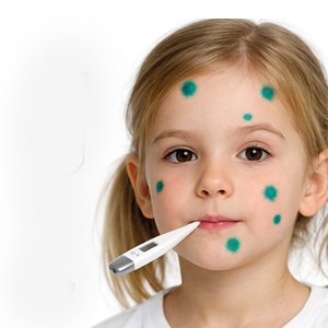 Вакцина против ветряной оспы в наличии в медицинском центре "здоровый ребенок"